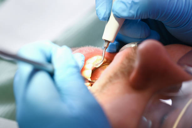 Best Emergency Treatment for Toothache in Wellsville, MO